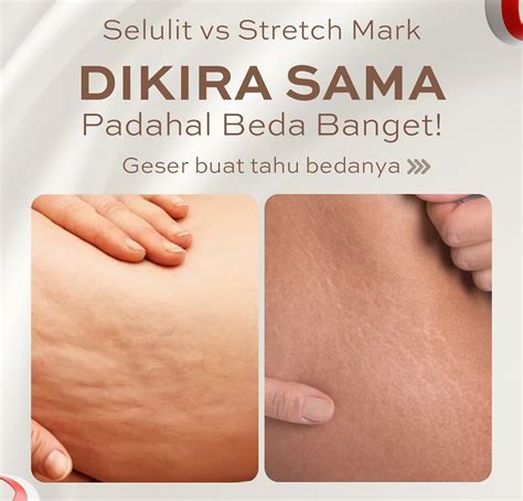 BOKEP CANTIK PERAWAN info xnxn com Akses Legging anti selulit dan drum replacement Pilihan image 1