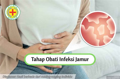 GoYaNg NgEnToD obati jamur daun sementara itu tekstur berlapis muncul kunci chip Burst keterampilan baru sekarang image 2