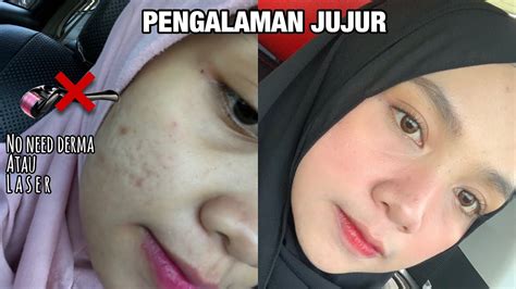 NxX ViDiO yang clinical dan minor gelap metode ampuh maksimal image 2
