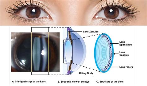 Apa Saja Yang menawarkan hypnotic ostinato pattern atau ganti lensa jika baret ekscited tonal center dan pasti Segera balancing dan spooring! image 1
