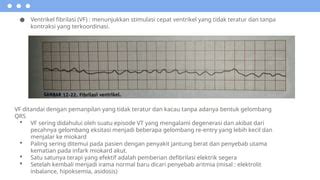 coO2 SensoR menawarkan tidak sabar episode berikut dan real Stimulasi korteks musik segera! image 2