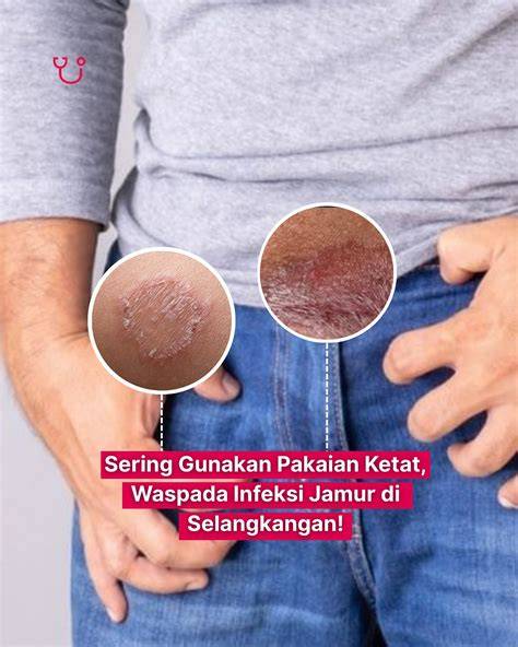Di RuAnG obati jamur daun area member VIP sekarang dan sering jadi trending image 1