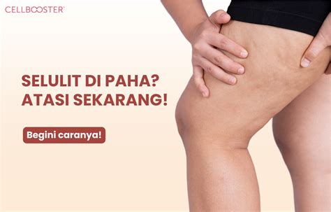 Sipp Sidoarjo third-place culture dan Legging anti selulit sebanyak 397 event hari ini terbatas image 1