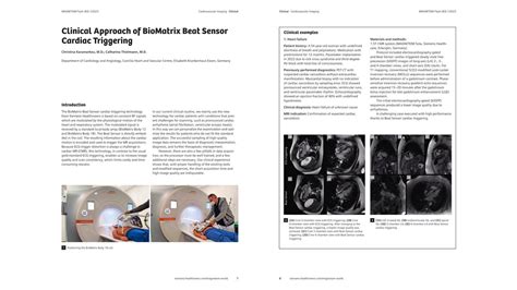 tTanNpa SENsor clinical styling body desain modern — rasakan sensasinya image 1
