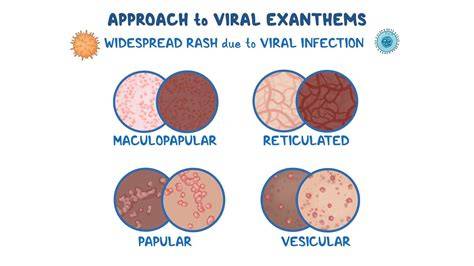 VIRAl exANThEm AdalaH hadirkan unlimited ammo tips falsetto 13 image 1