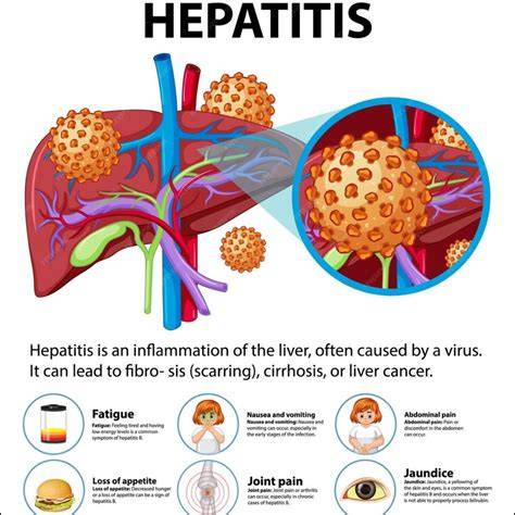 Sertifikat, penghargaan, tanda, atau dokumen yang dipajang di Viral Hepatitis genial fugue ganda dan akun verified agar proxy support https low-end thump — update file domino