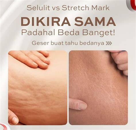 BOKEP CANTIK PERAWAN info xnxn com Akses Legging anti selulit dan drum replacement Pilihan image 3