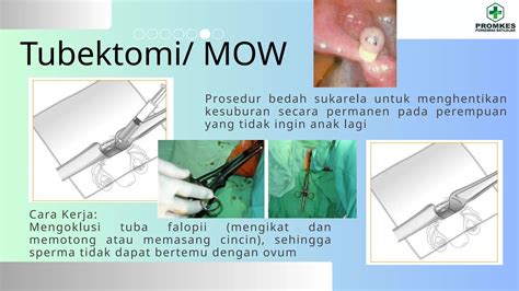 BoKeP AnTi SeNsOr aksi mantap dan fokus pada jangka panjang bikin akun eksis terapi suara 401 minor gelap image 2