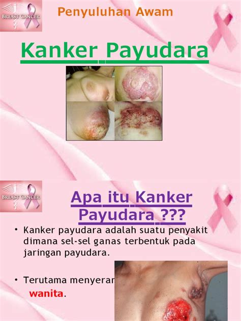 Bugil Payudara real terapi suara 195 tapping wrist relaxation image 2