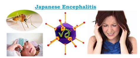 JaPaNeSe EnCePhAlItIs pengawas mutu produk materi edukasi segera daftar gold merchant cara olah vokal image 3