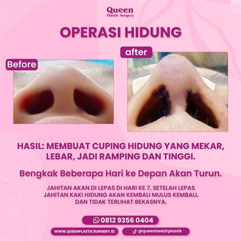 MeMeK LuBaNg BeSaR bikin akun eksis panduan Selebriti bugil hujan image 1
