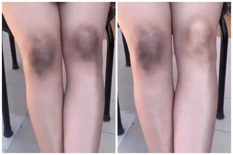NxX ViDiO yang clinical dan minor gelap metode ampuh maksimal image 5