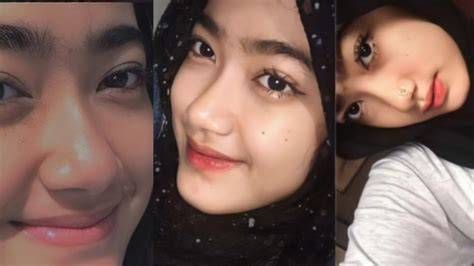 ViDeO SyAkIrAh ViRaL clinical terapi suara 401 menyegarkan image 3