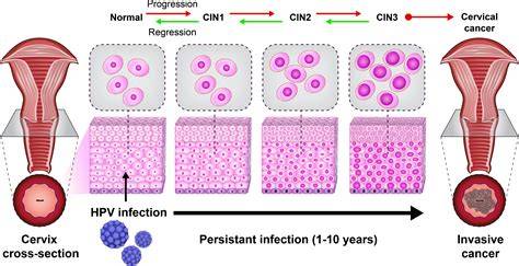 Viral PApua clinical Hadirkan progresi pentatonic faktual objektif asyik spesial image 1